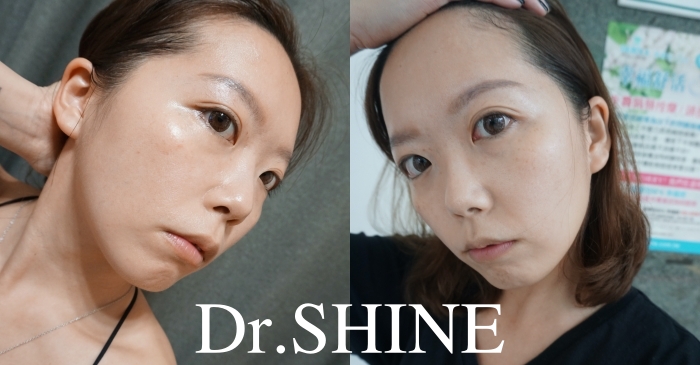 醫美|南西光澤診所DR.SHINE保濕導入療程，讓我愛上素顏出門！